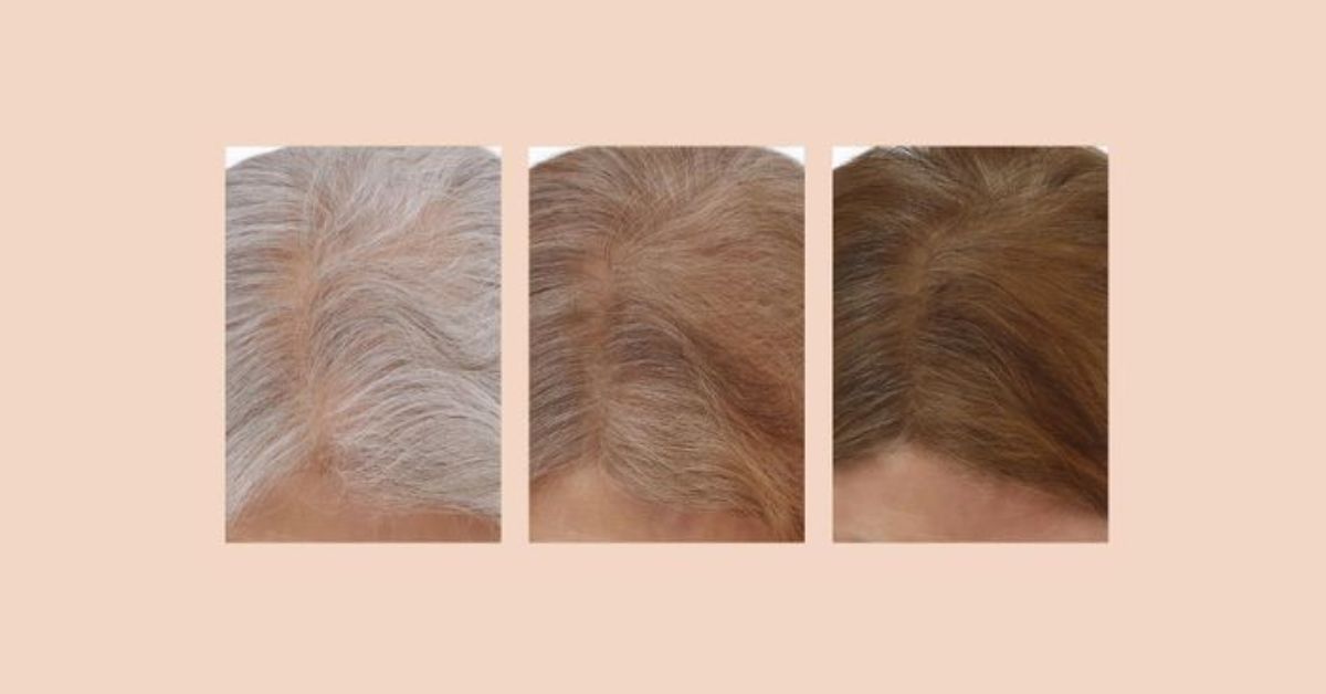 Pictures showing hair darkening from grey to brown with before, after 1 week use and after 2 weeks use